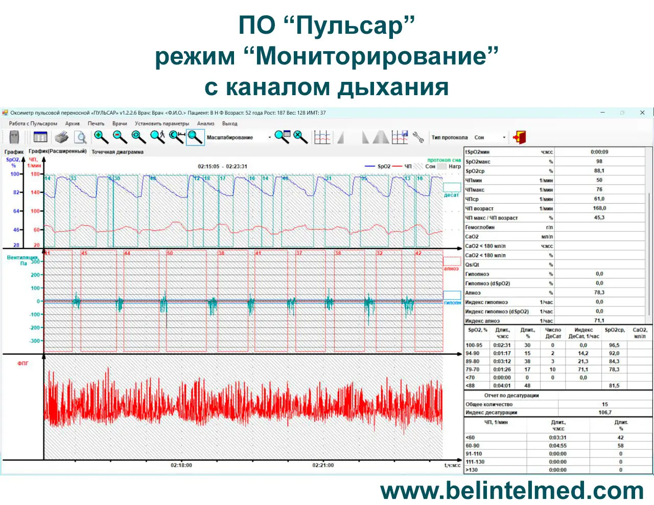Протоколы мониторирования Пульсоксиметра Пульсар-М2 мини ПО Пульсар с каналом дыхания, АПНОЭ-монитор