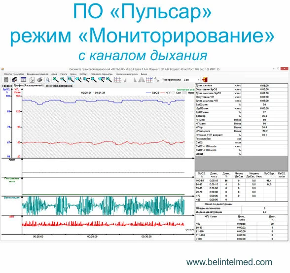 Протоколы мониторирования Пульсоксиметра Пульсар-М2 ПО Пульсар с дыханием